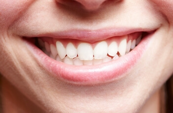 Close-up of a healthy smile