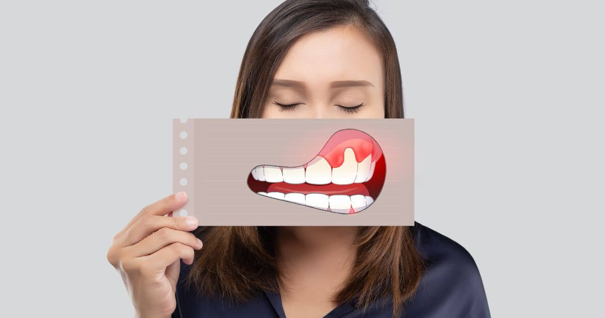 Woman with inflamed, irritated gums
